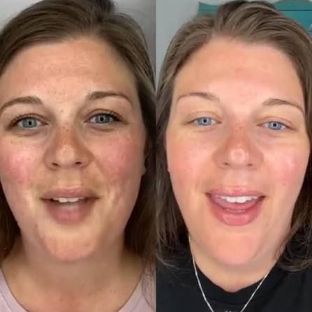 Before and after — Emily R.